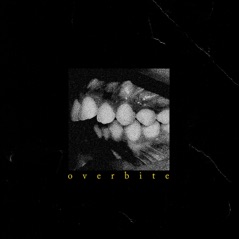 Overbite (Single Edit) - Single