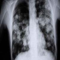 FUMO MUCHO! (feat. nnanitooo) - Single - 27.Bensh