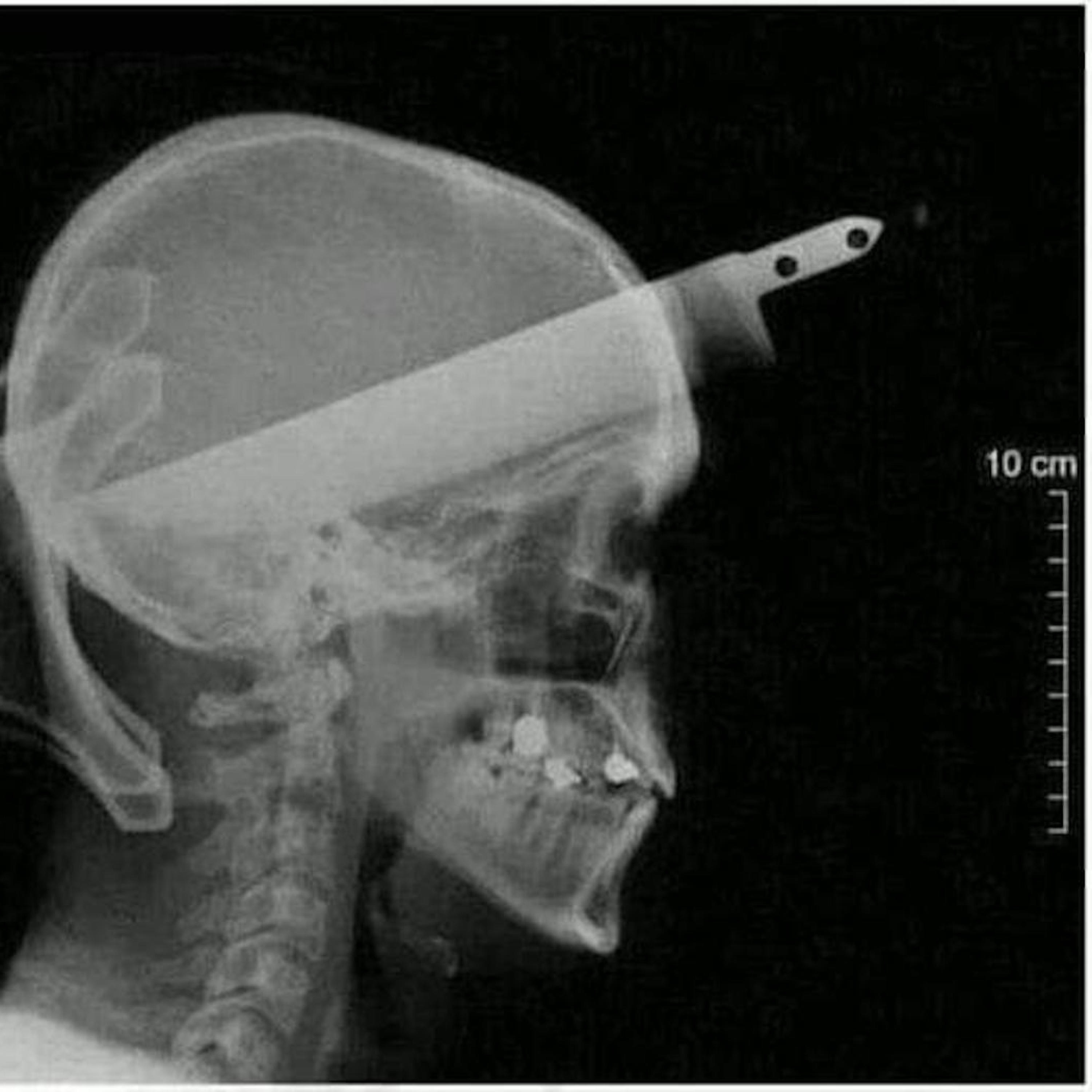 Swallow You Down - Single