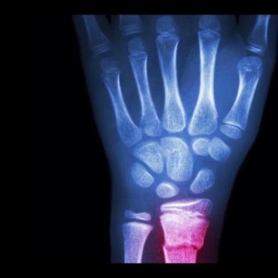 Broke my wrist (feat. Otr Cutty) - Single