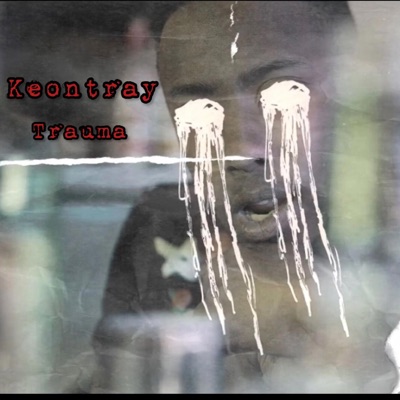 Trauma - Single