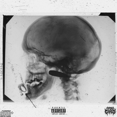 Pain In the Nekk - Single