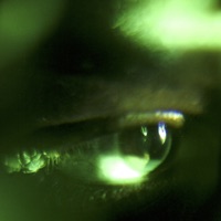 mellan - Single - dakim