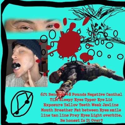 Chudge - Proper Alignment of the Tongue and Oral Posture To Influence the Craniofacial Complex