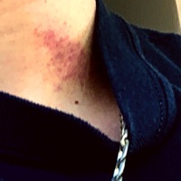 Hickeys - Single - T-Rain