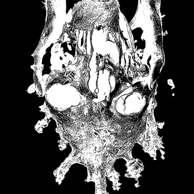 The Rot King - Single