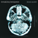 I Will Not Bow - Breaking Benjamin
