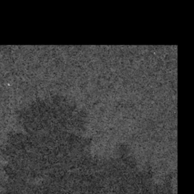 Unfortunately (Expd)