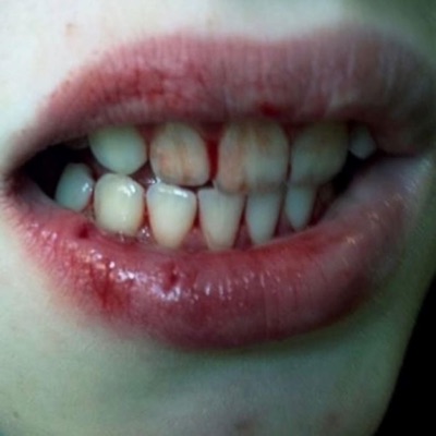 $he Remind$ Me of Drug$