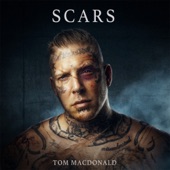 Scars artwork