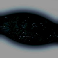 Devastating Brain Injury - Jordan Keuring