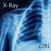 X-Ray - Single