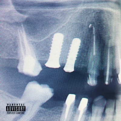 ABCÈS - EP