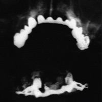 let me talk (feat. reefuh) - Single - Kurtis