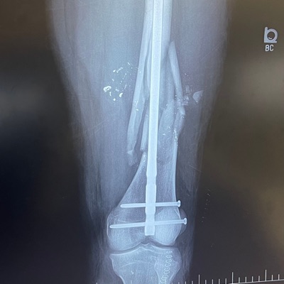 Si Vis Pacem Para Bellum - EP