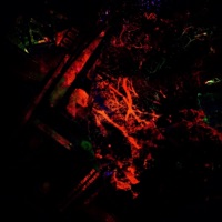 The Cure, The Girl, The Illness and the Mysterious Garden of Despair - EP - Abc