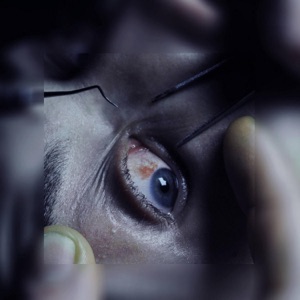 Control - EP