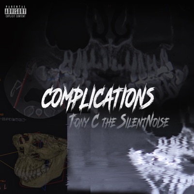 Complications