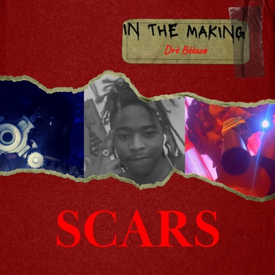 Scars "In the Making"
