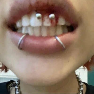 BLOOD ON THE TEETH (feat. PINKBLXXD) - Single