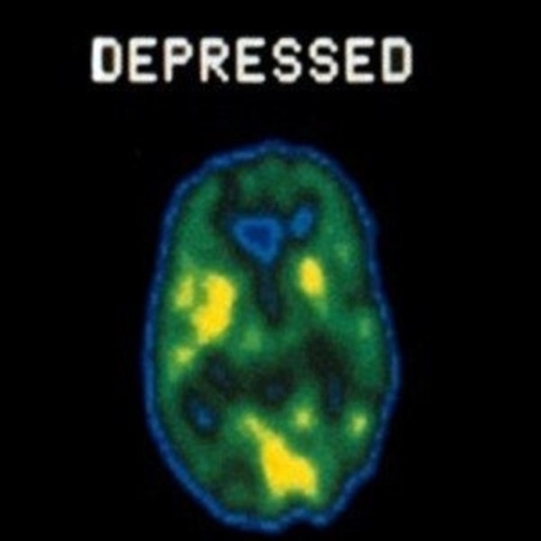 Depressed (feat. Texako)