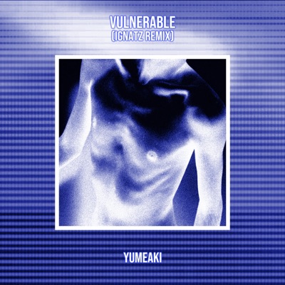 Vulnerable (Ignatz Remix) [feat. Ignatz] - Single