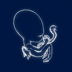 Sigur Rós - Starálfur