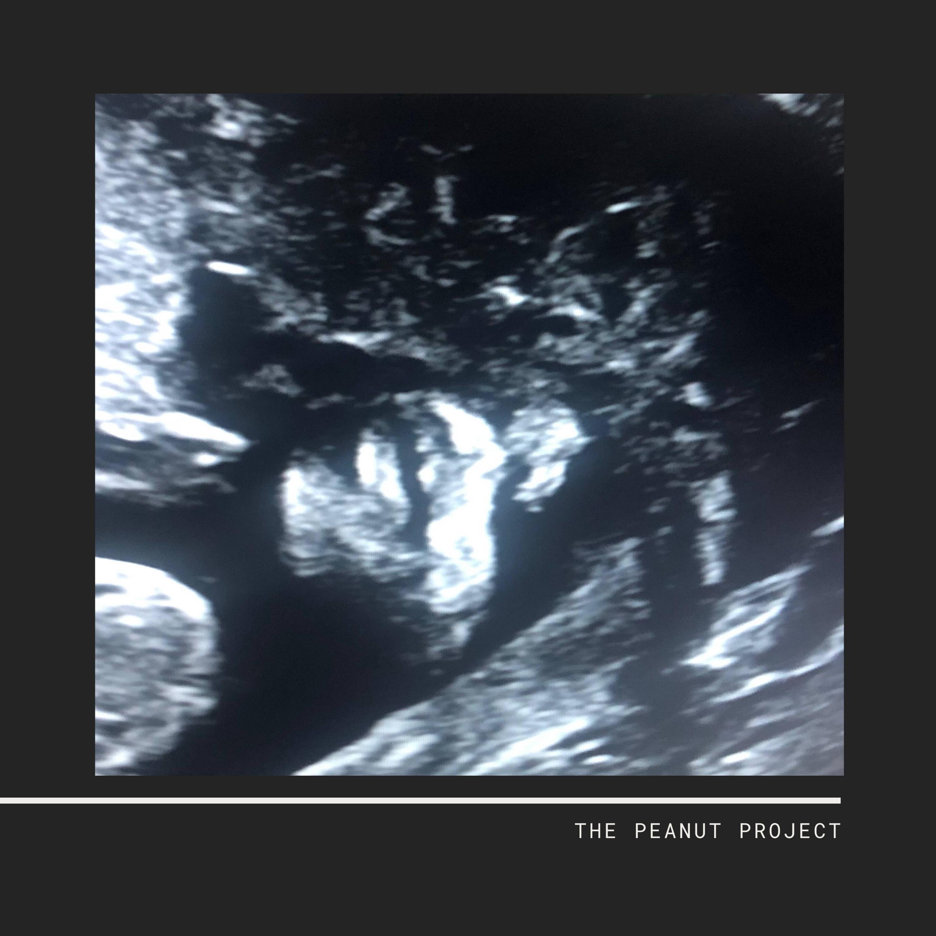 The Peanut Project