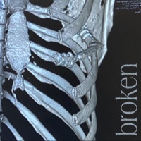 Broken - Single - Koji