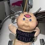 Unexpected Fetus