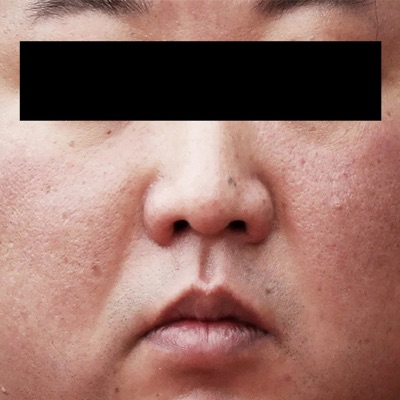 Støt Livsstilen (feat. Jørgen Ryge, kasperbroue & Fabeldyret) - EP