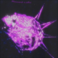 Missed Calls - Single - Odon