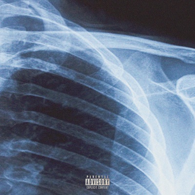 X-Ray - Single