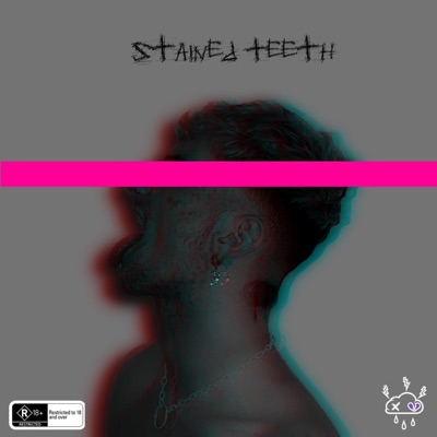 Stained Teeth - Single