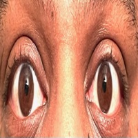 My Eyes - Single - 3RDiE