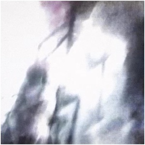 anything else - Single