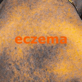 Eczema jotty