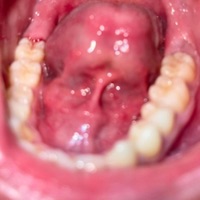 Awake (feat. Gryphøn) - Single - Nix Vuitton