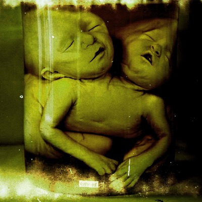 Empty Bones - Single