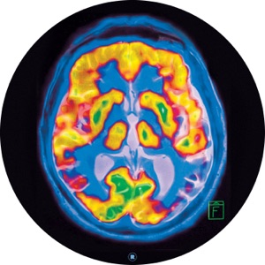 Brainscan - Single