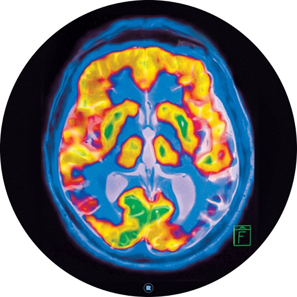 Brainscan - Single