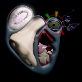 Remedies of Moving On sedate