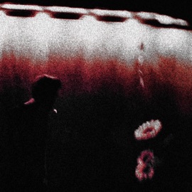 ICanScreamAlliWantNobodyWillHearMe Biv