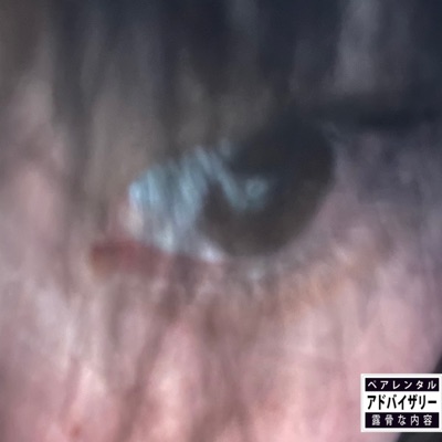 Alas (Cyberpsychosis Version) - Single