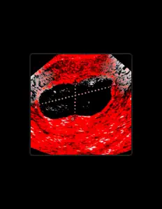 聆聽 iLLibOi、觀看音樂影片、閱讀小傳、查看巡演日期等！