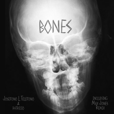 Bones - Single