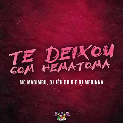 Te Deixou Com Hematoma - Single