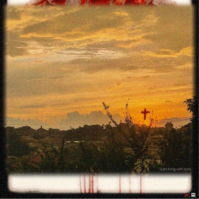 Scars Living With Scars