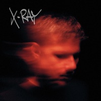 X - Ray - Murdock