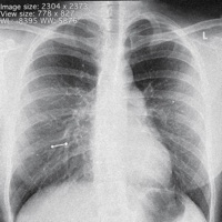 IINSIIDE OUT - Single - Kidnfinity